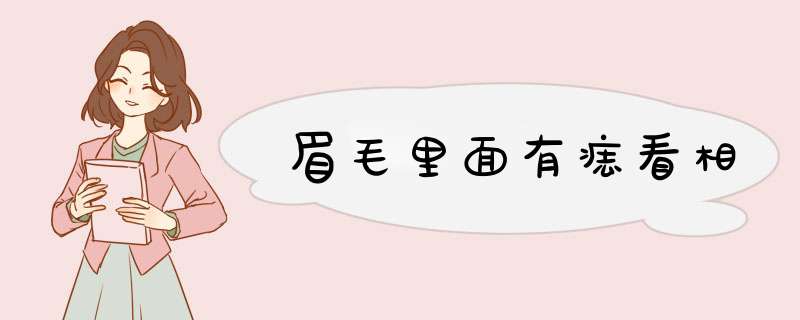 眉毛里面有痣看相,第1张